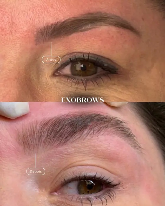 ExoBrows, before and after
