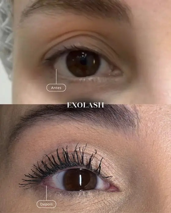ExoLash, before and after