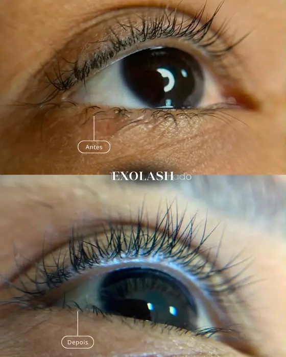 ExoLash, before and after